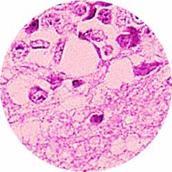 Microscopic image of tissue